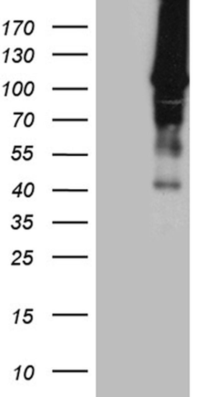 HACE1 Antibody in Western Blot (WB)