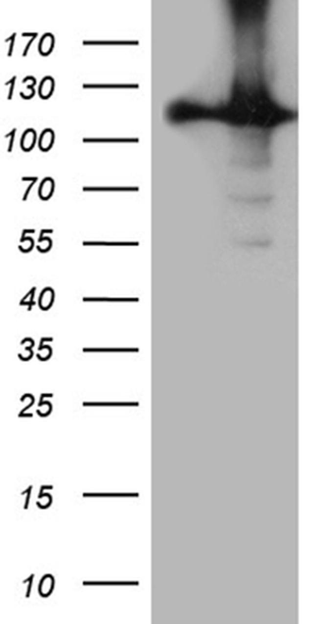 HACE1 Antibody in Western Blot (WB)