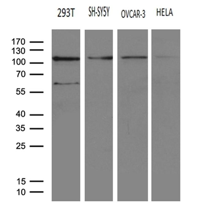 HACE1 Antibody in Western Blot (WB)