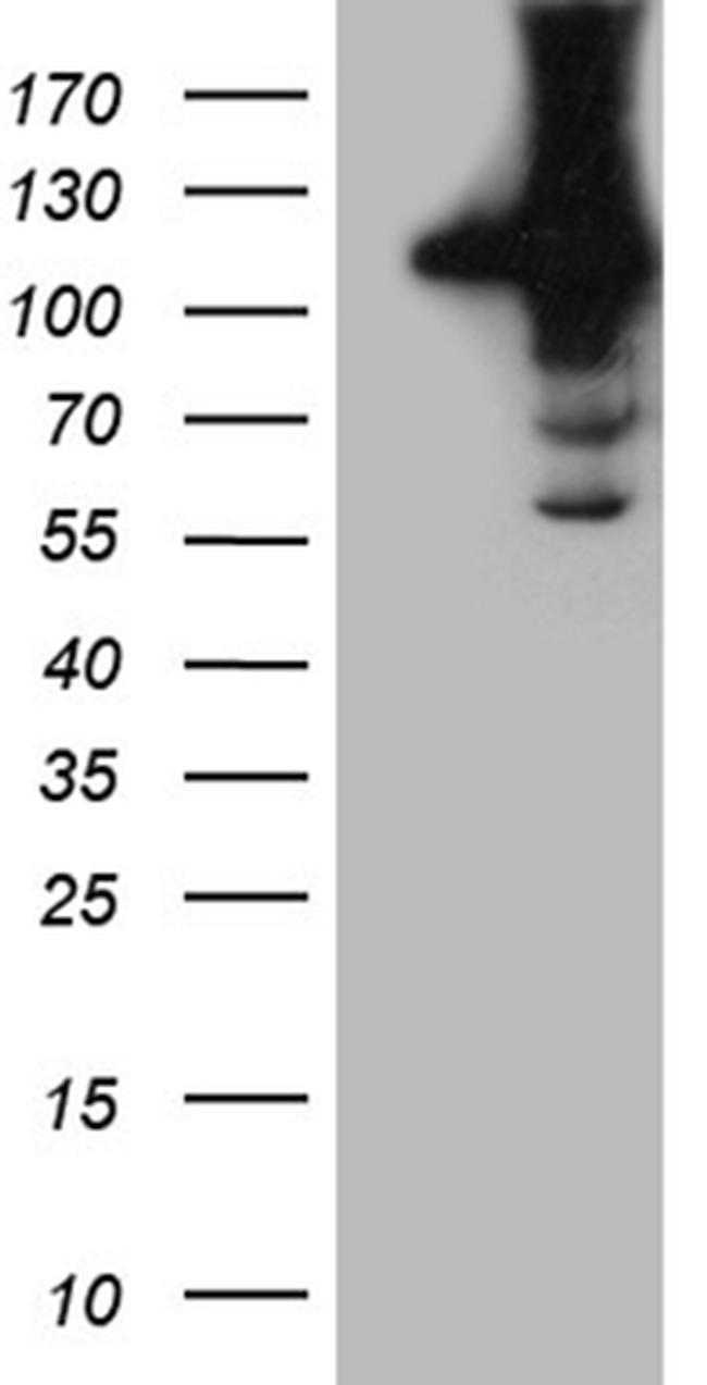 HACE1 Antibody in Western Blot (WB)