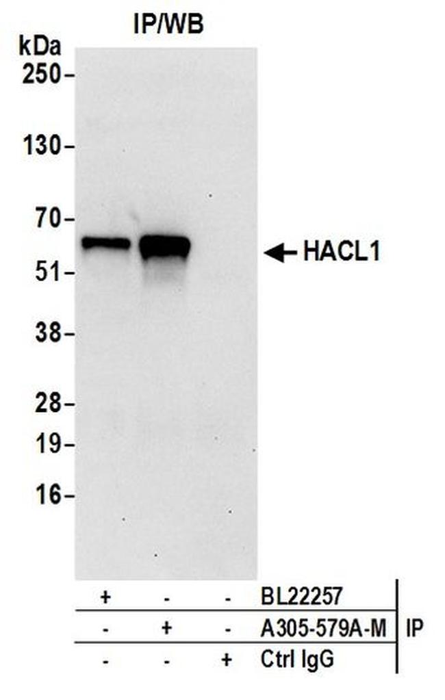 HACL1 Antibody in Western Blot (WB)