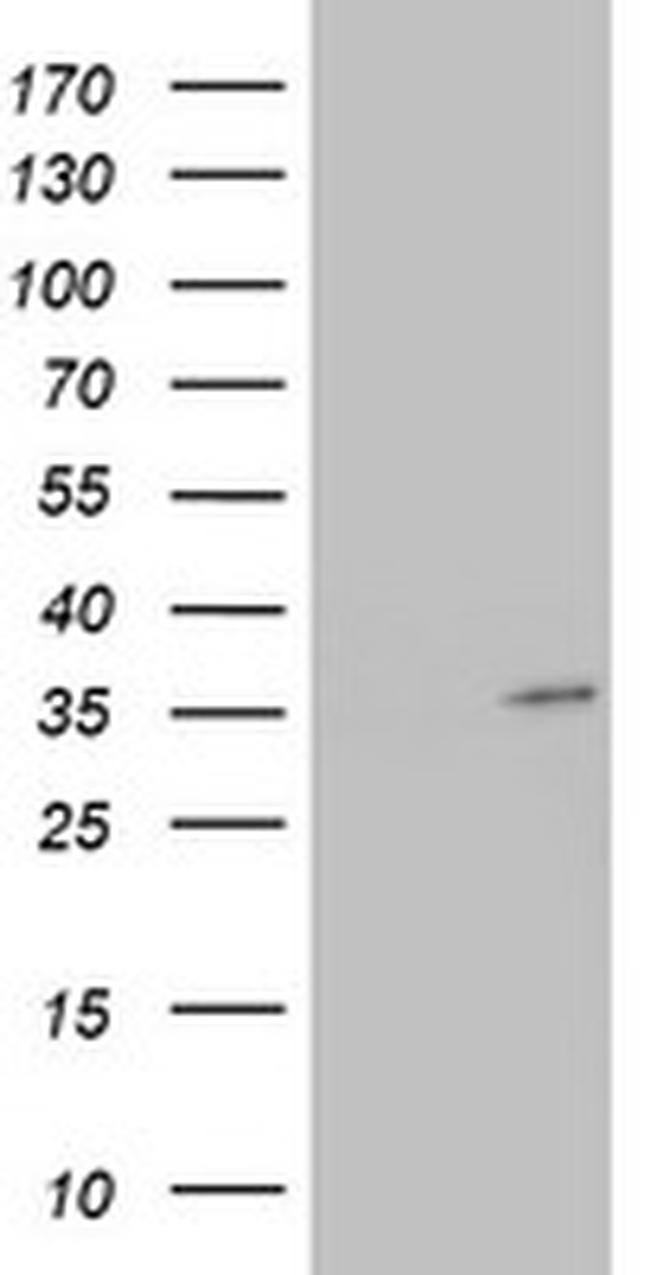 HADH Antibody in Western Blot (WB)