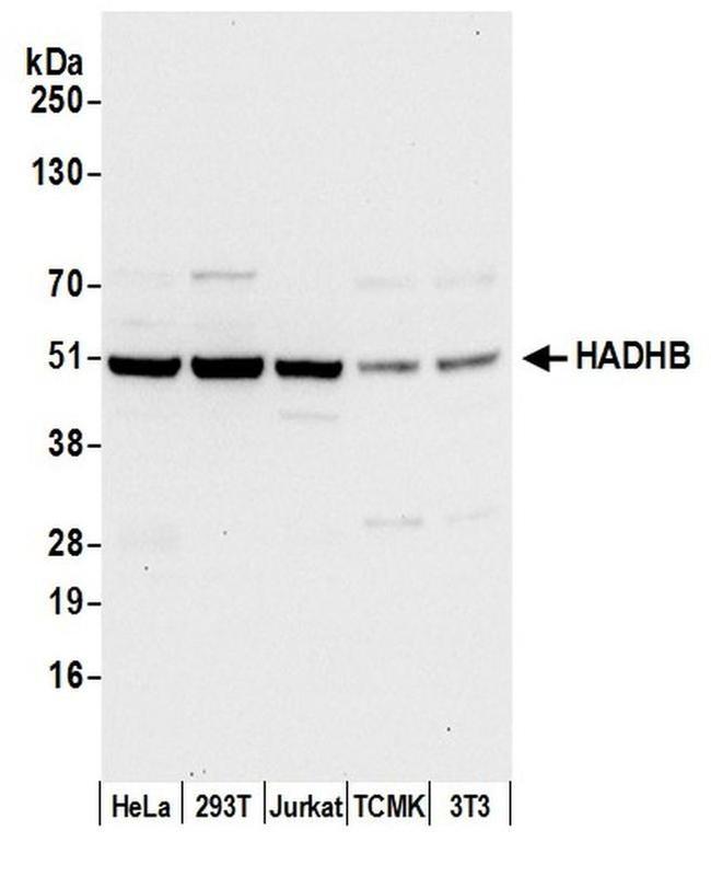 HADHB Antibody in Western Blot (WB)