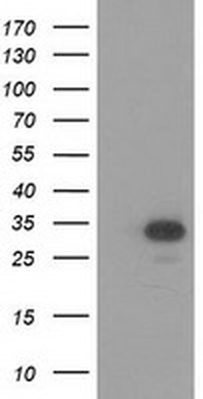 HAGHL Antibody in Western Blot (WB)