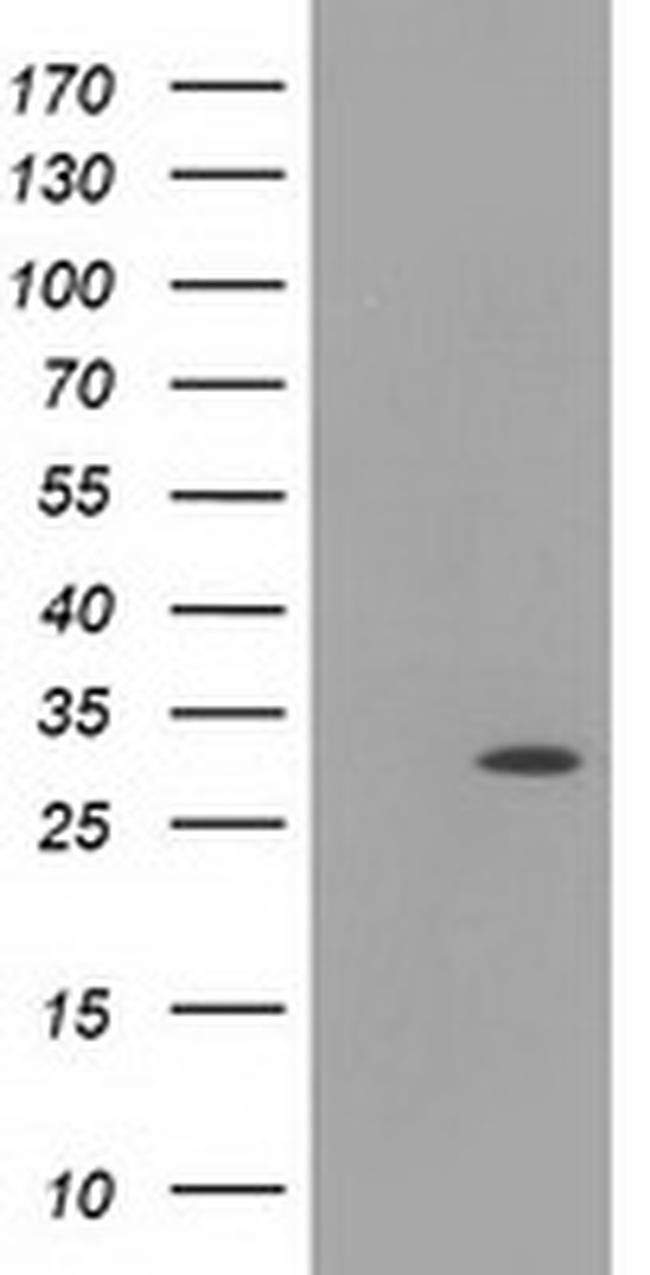 HAGHL Antibody in Western Blot (WB)