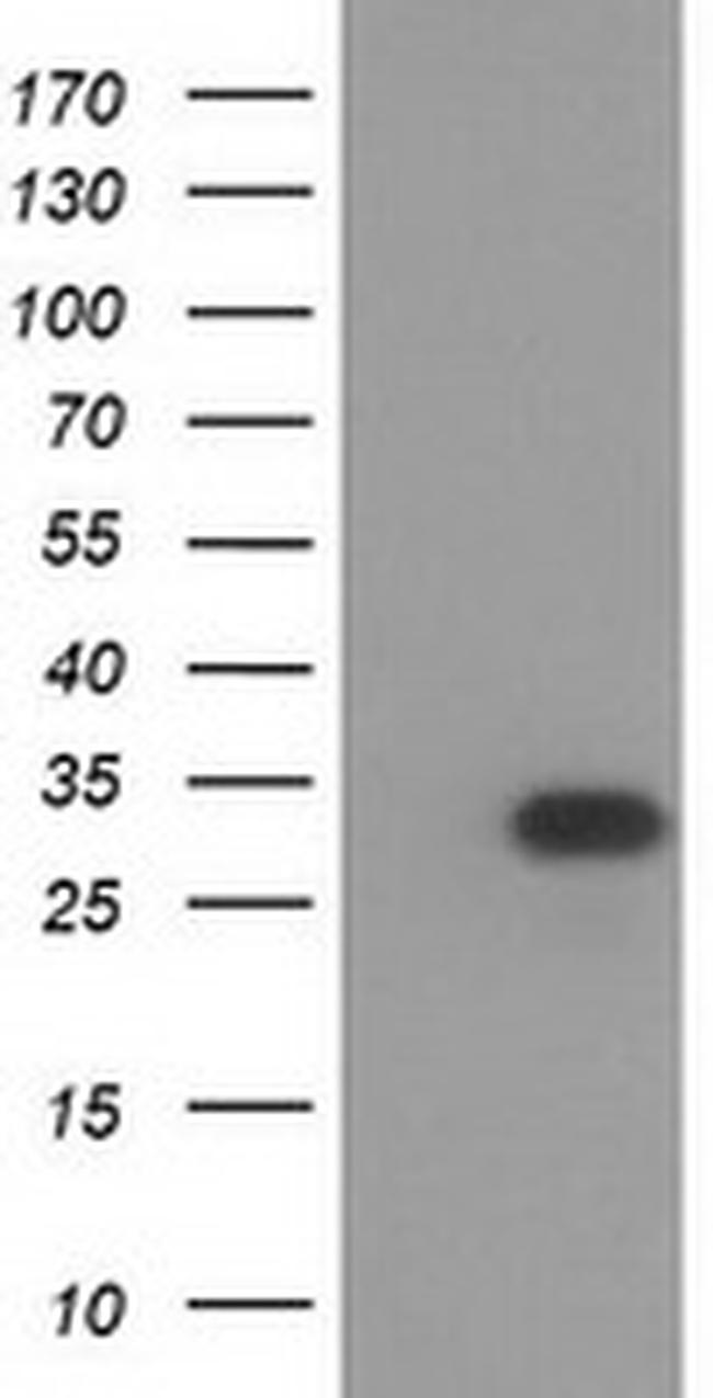 HAGHL Antibody in Western Blot (WB)