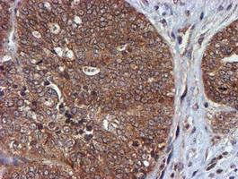 HARS2 Antibody in Immunohistochemistry (Paraffin) (IHC (P))