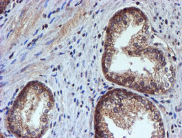 HARS2 Antibody in Immunohistochemistry (Paraffin) (IHC (P))