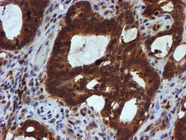 HARS2 Antibody in Immunohistochemistry (Paraffin) (IHC (P))