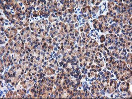 HARS2 Antibody in Immunohistochemistry (Paraffin) (IHC (P))