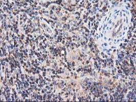 HARS2 Antibody in Immunohistochemistry (Paraffin) (IHC (P))