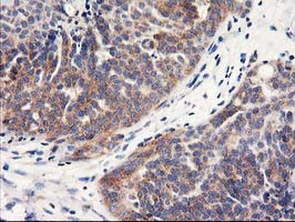 HARS2 Antibody in Immunohistochemistry (Paraffin) (IHC (P))