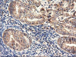 HARS2 Antibody in Immunohistochemistry (Paraffin) (IHC (P))