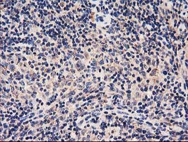 HARS2 Antibody in Immunohistochemistry (Paraffin) (IHC (P))