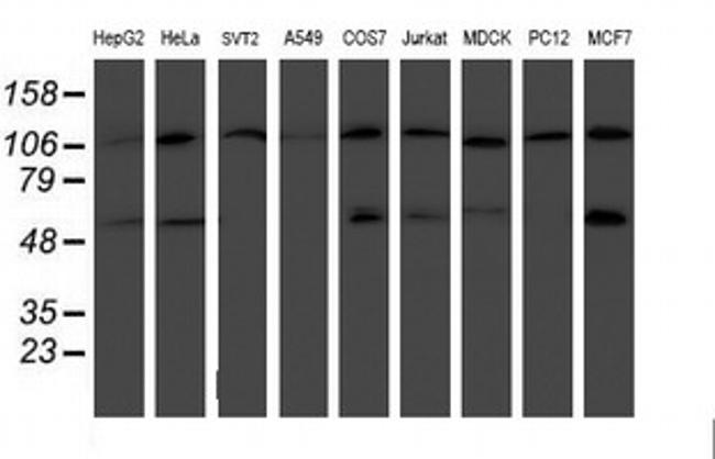 HARS2 Antibody in Western Blot (WB)