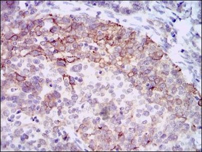 HAS3 Antibody in Immunohistochemistry (Paraffin) (IHC (P))