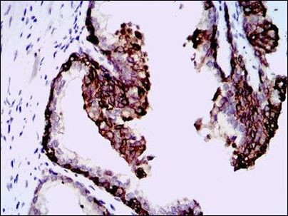 HAS3 Antibody in Immunohistochemistry (Paraffin) (IHC (P))