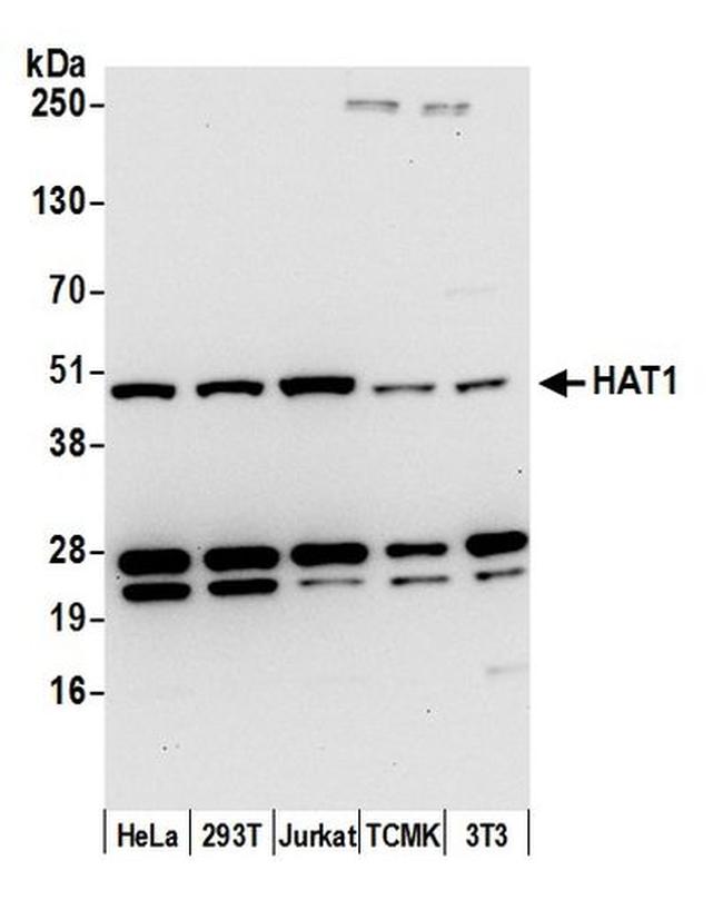 HAT1/KAT1 Antibody in Western Blot (WB)