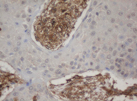HBS1L Antibody in Immunohistochemistry (Paraffin) (IHC (P))