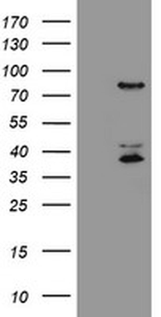 HCFC2 Antibody in Western Blot (WB)