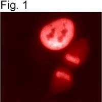 HDAC1 Antibody in Immunocytochemistry (ICC/IF)