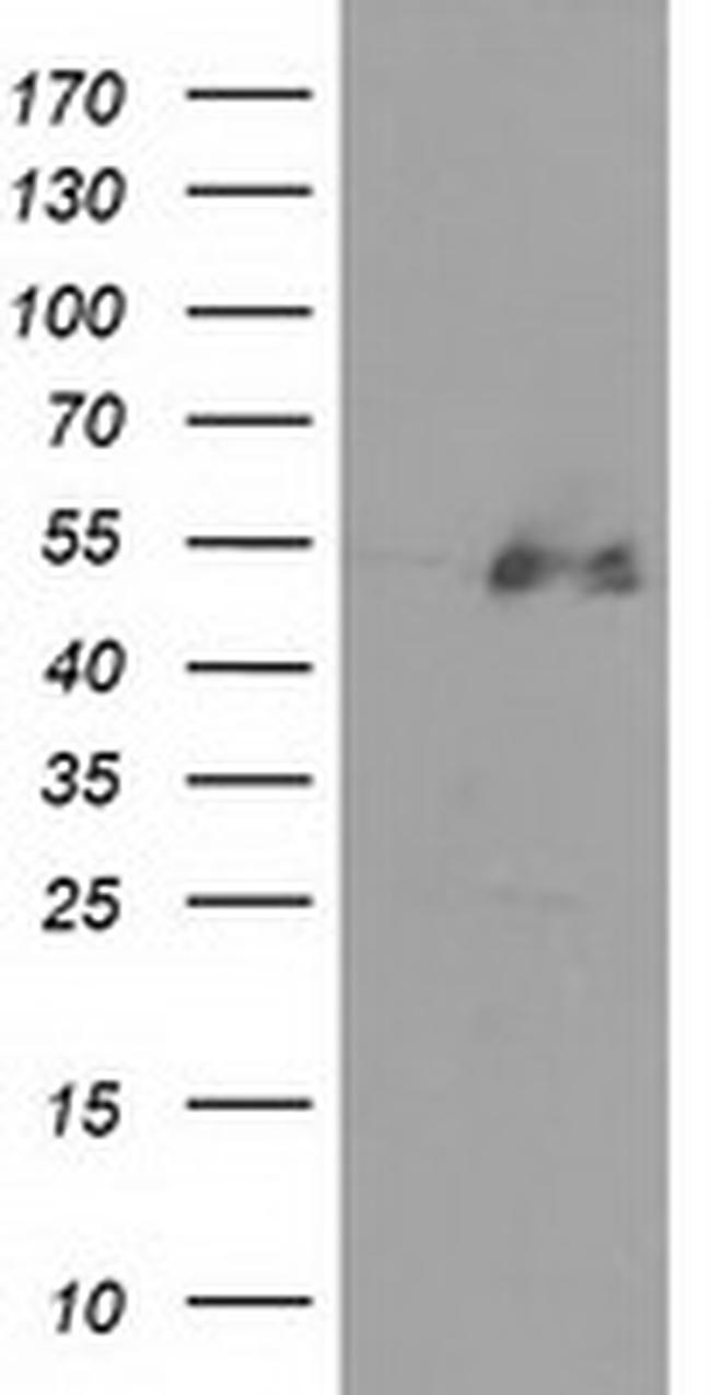 HDAC1 Antibody in Western Blot (WB)