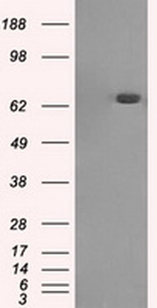 HDAC10 Antibody in Western Blot (WB)