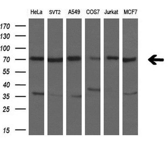 HDAC10 Antibody in Western Blot (WB)