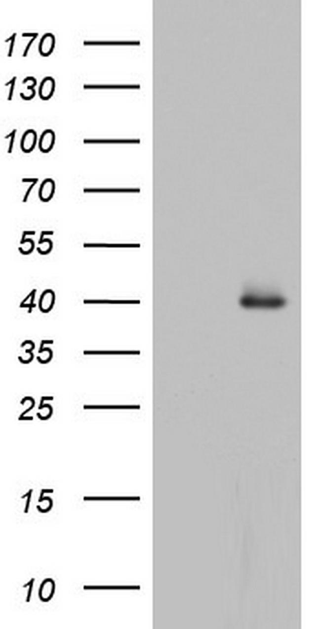 HDAC11 Antibody in Western Blot (WB)