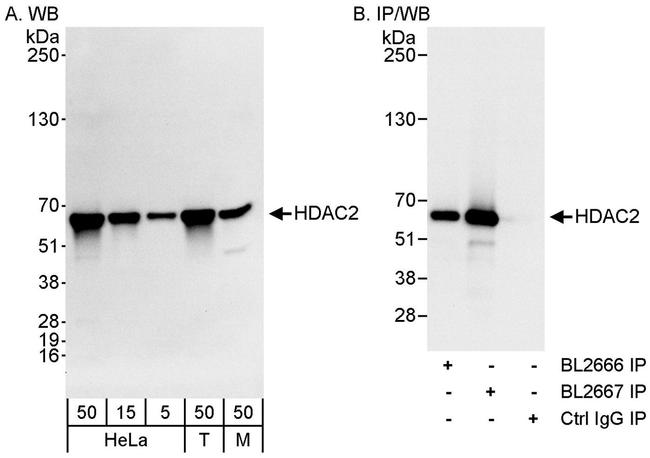 HDAC2 Antibody in Western Blot (WB)