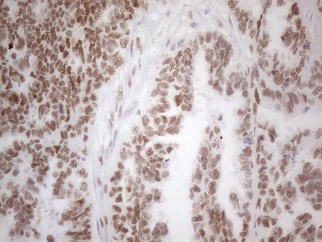 HDAC2 Antibody in Immunohistochemistry (Paraffin) (IHC (P))