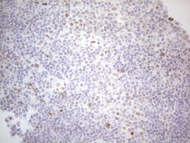 HDAC2 Antibody in Immunohistochemistry (Paraffin) (IHC (P))