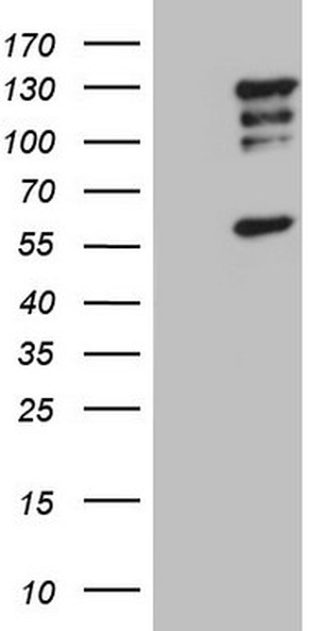 HDAC4 Antibody in Western Blot (WB)