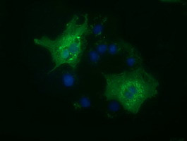 HDAC6 Antibody in Immunocytochemistry (ICC/IF)