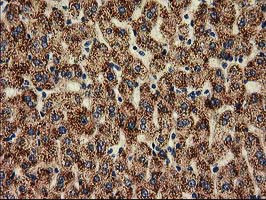 HDAC6 Antibody in Immunohistochemistry (Paraffin) (IHC (P))