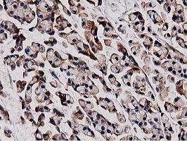 HDAC6 Antibody in Immunohistochemistry (Paraffin) (IHC (P))