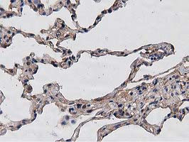 HDAC6 Antibody in Immunohistochemistry (Paraffin) (IHC (P))