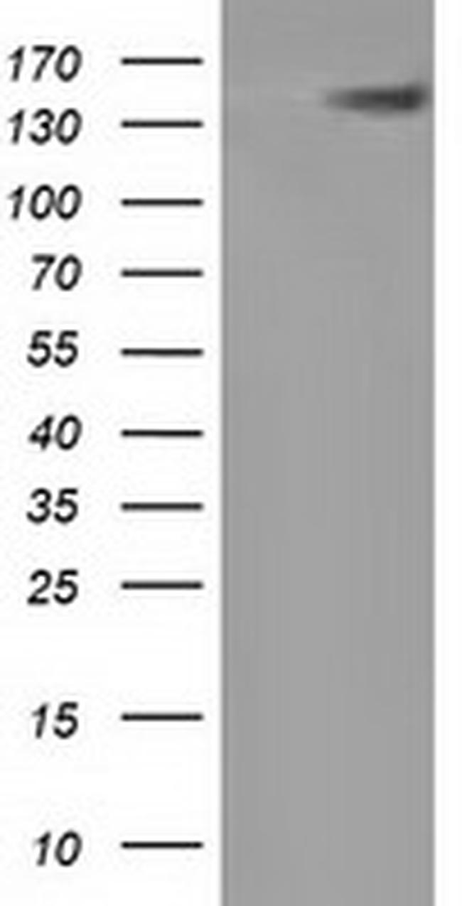 HDAC6 Antibody in Western Blot (WB)