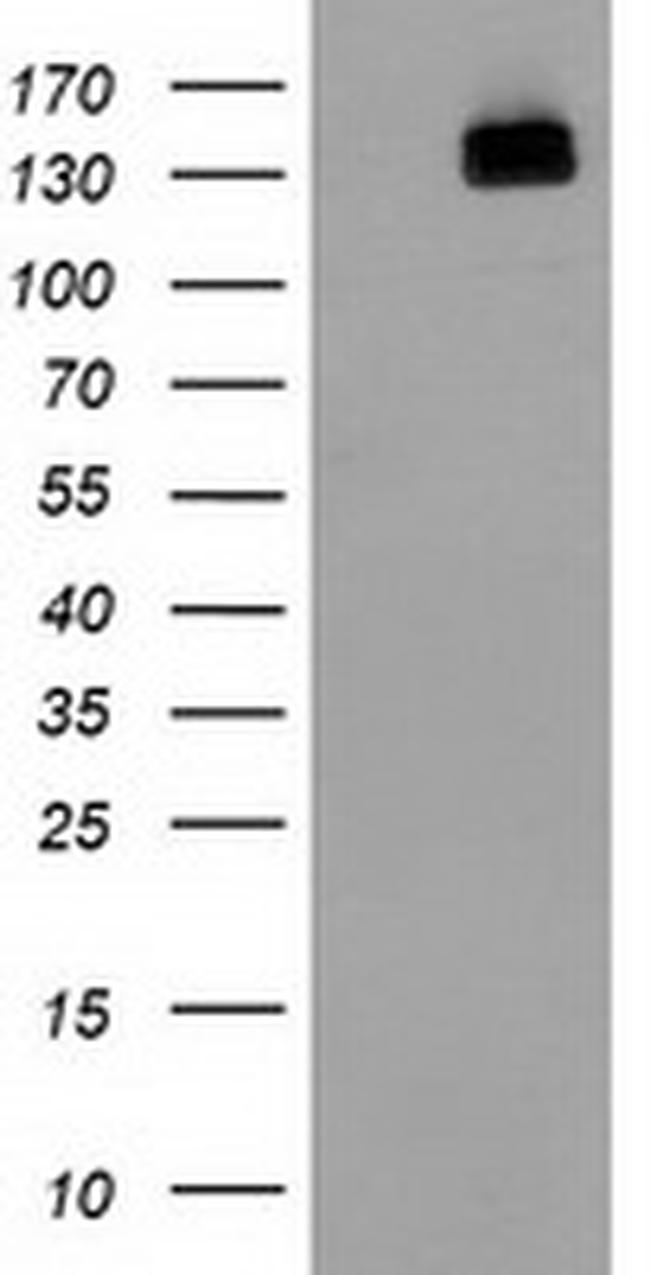 HDAC6 Antibody in Western Blot (WB)