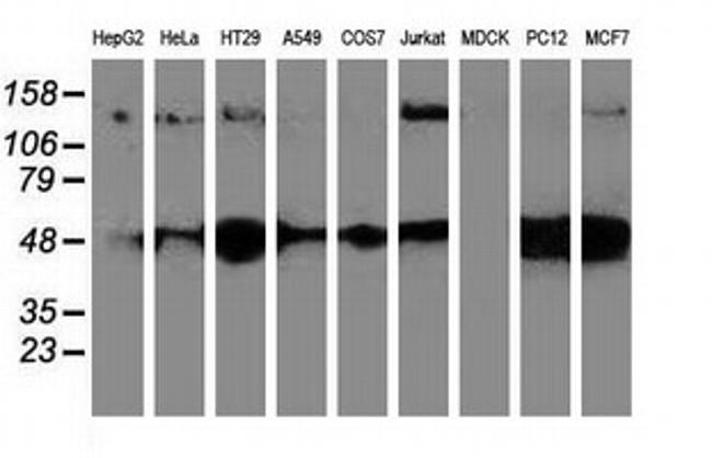 HDAC6 Antibody in Western Blot (WB)