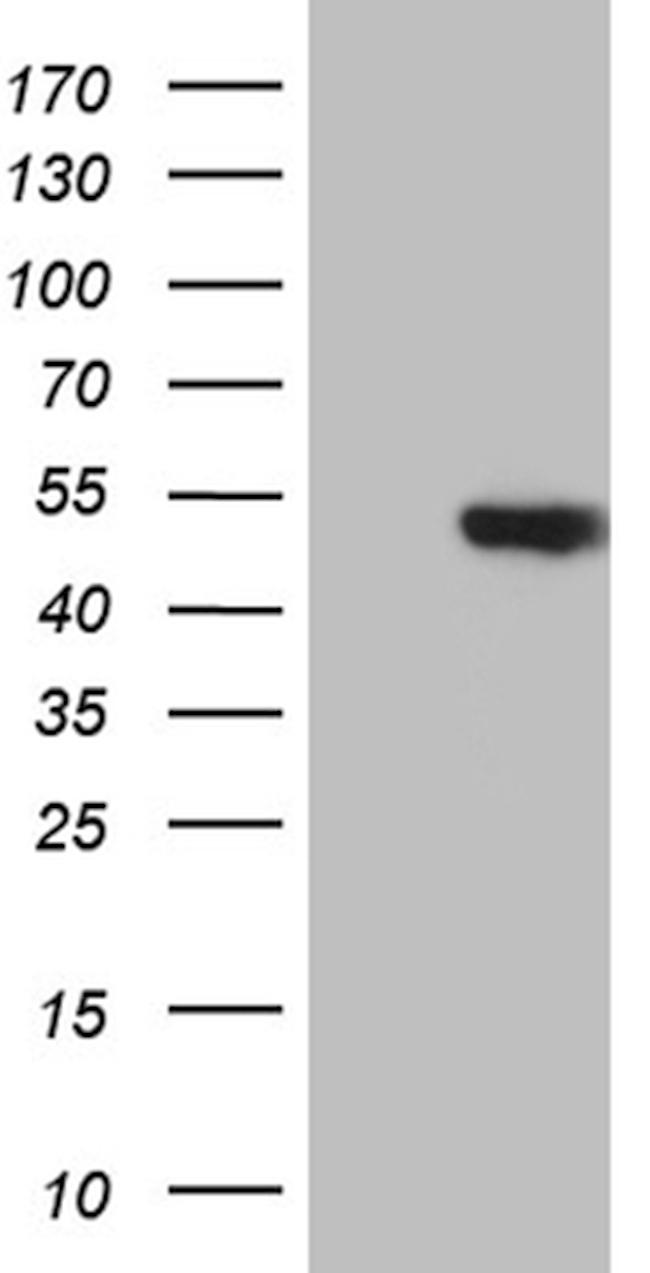 HDAC8 Antibody in Western Blot (WB)