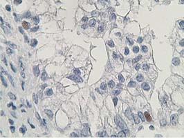 HDHD2 Antibody in Immunohistochemistry (Paraffin) (IHC (P))