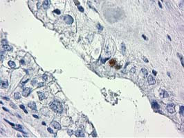 HDHD2 Antibody in Immunohistochemistry (Paraffin) (IHC (P))