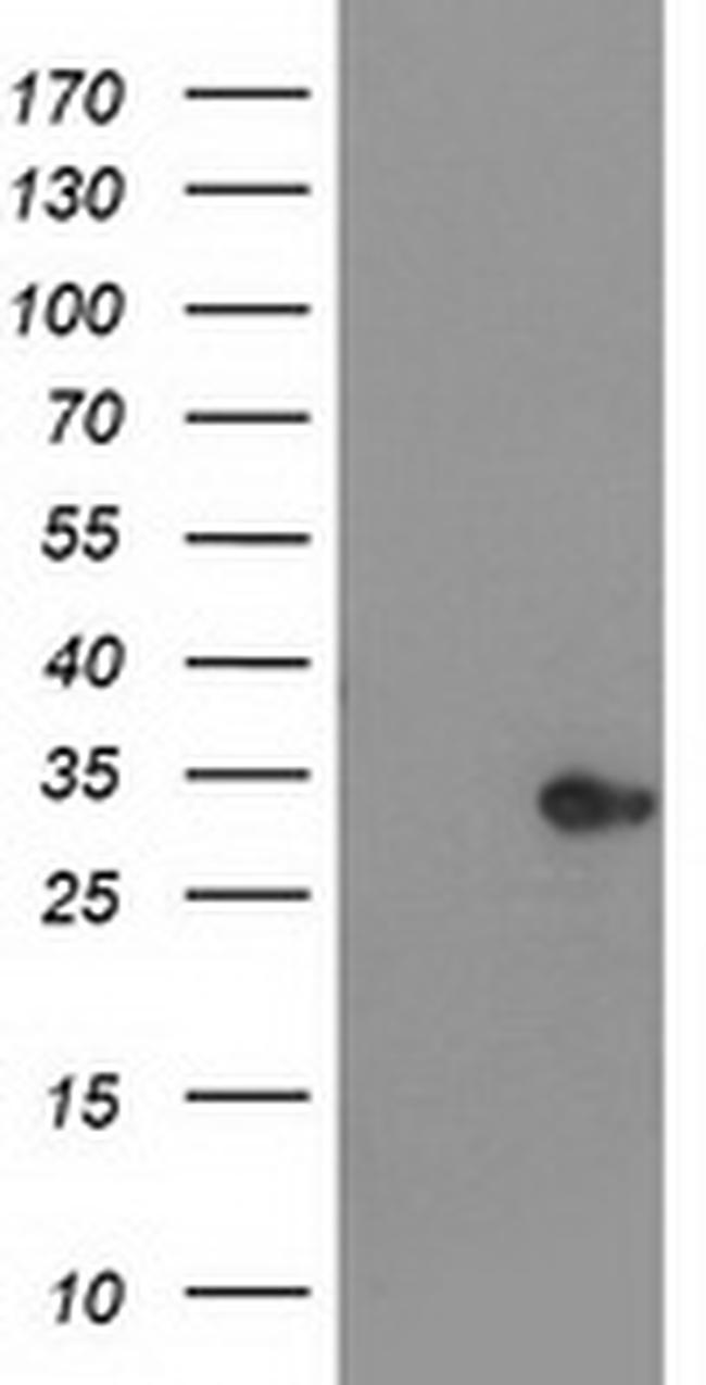 HDHD2 Antibody in Western Blot (WB)