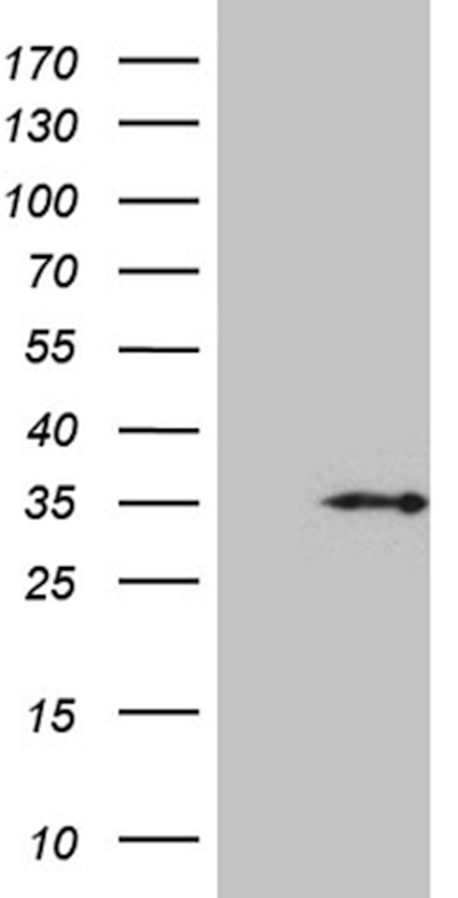 HDHD3 Antibody in Western Blot (WB)