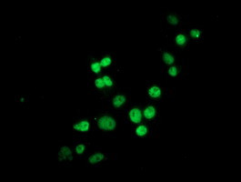 HES1 Antibody in Immunocytochemistry (ICC/IF)