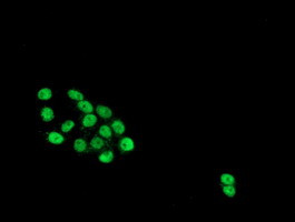 HES1 Antibody in Immunocytochemistry (ICC/IF)