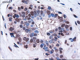 HES1 Antibody in Immunohistochemistry (Paraffin) (IHC (P))