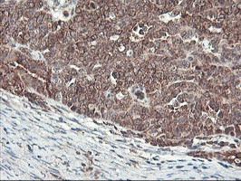 HES1 Antibody in Immunohistochemistry (Paraffin) (IHC (P))