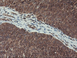 HES1 Antibody in Immunohistochemistry (Paraffin) (IHC (P))